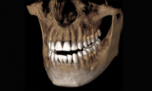 Wichita Dental CT Scan